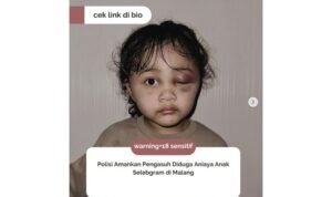 anak-dianiaya-suster-penjaga